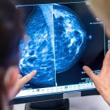 Affidea est présent en Suisse depuis 2007 avec un réseau de 15 centres de soins dans l'imagerie médicale, le diagnostic, la gastro-entérologie, ainsi que le traitement du cancer du sein. (archives) KEYSTONE/DPA/HANNIBAL HANSCHKE